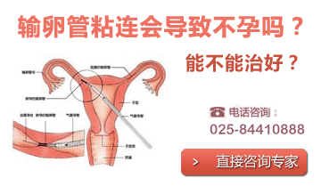 Ͼѹɡճ
