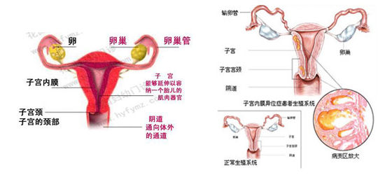 常见的卵巢疾病有卵巢肿瘤,多囊卵巢,卵巢位置异常,卵巢炎等