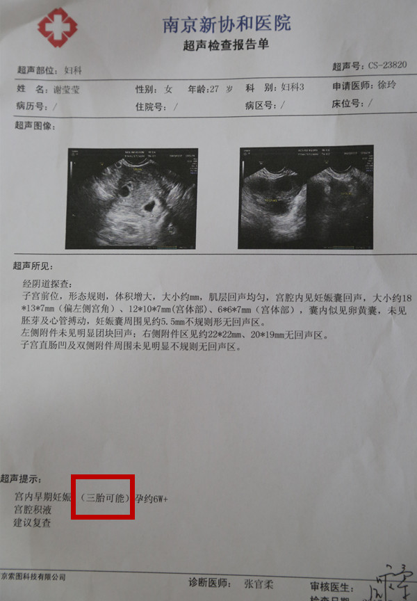 不孕则已，一孕就是三胞胎
